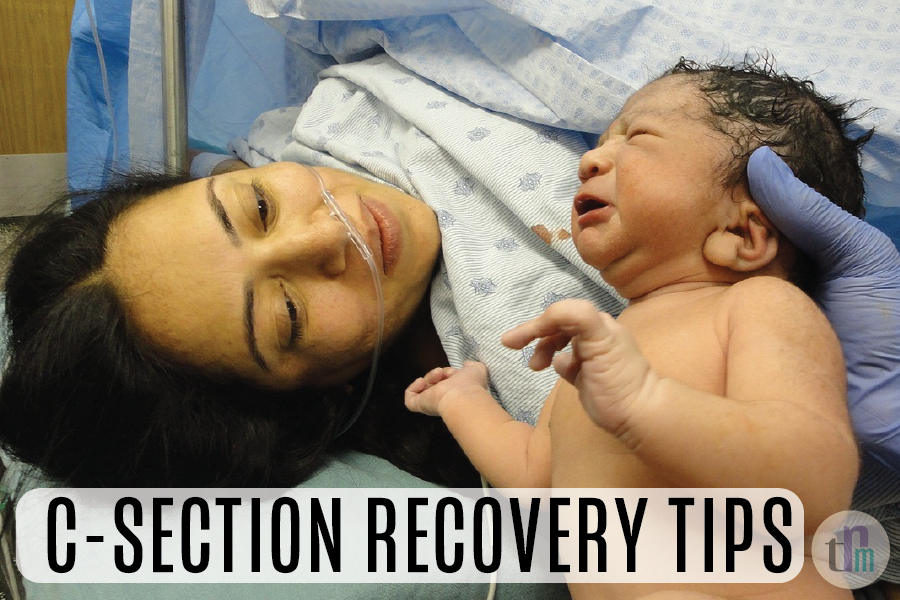 C-Section Moms: Tips and Support for Recovery